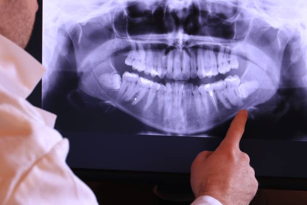 Best Emergency Denture Repair in Lowell, OR