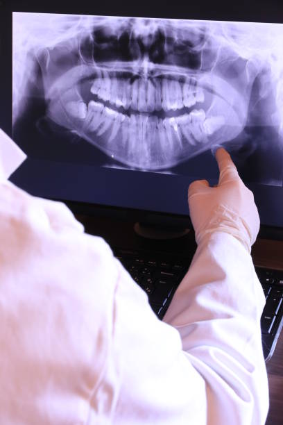 Best Emergency Tooth Extraction in Lowell, OR