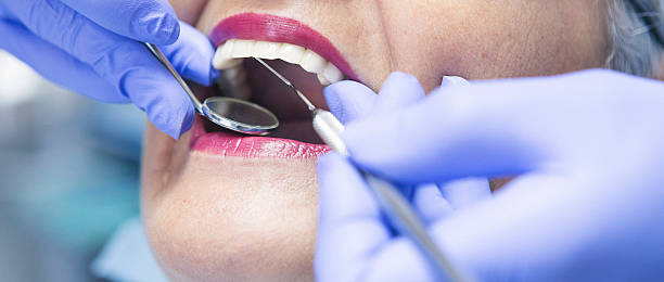 Best Emergency Treatment for Dental Infections or Abscesses in Lowell, OR